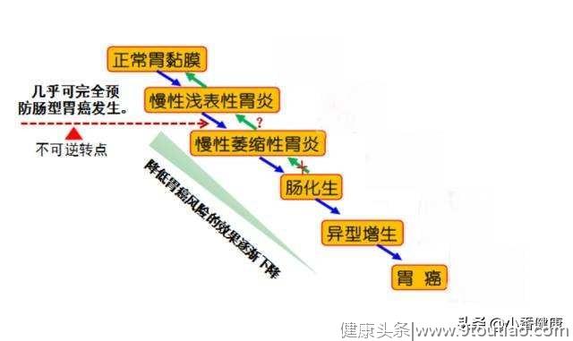 幽门螺杆菌致胃癌 消瘦恶心上腹部饱胀 除胃镜还需筛查HP