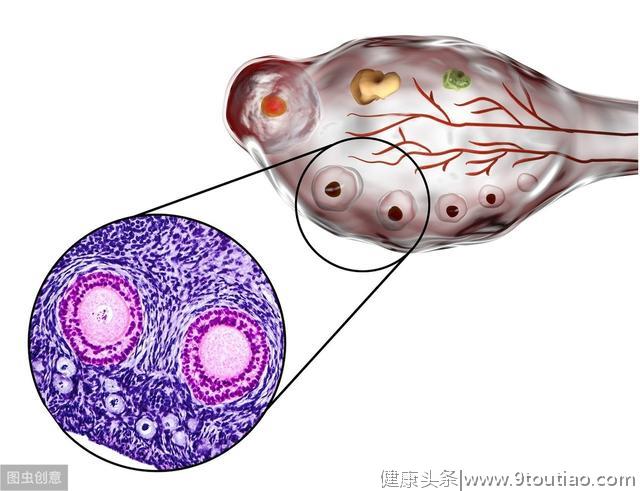 前后患上卵巢癌、乳腺癌，母女俩都测出相关基因突变