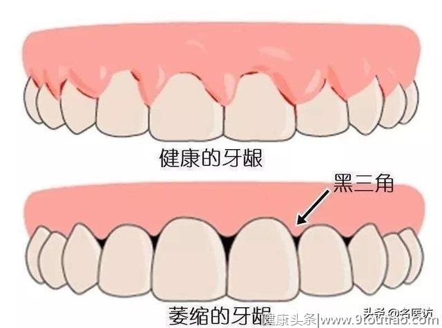 想矫正牙齿却屡屡退缩，谁才是你正畸路上的拦路虎？