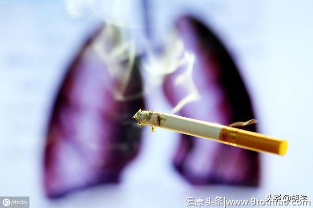 肺癌和吸烟之间的关系毋庸置疑，六分之一抽烟人群死于肺癌