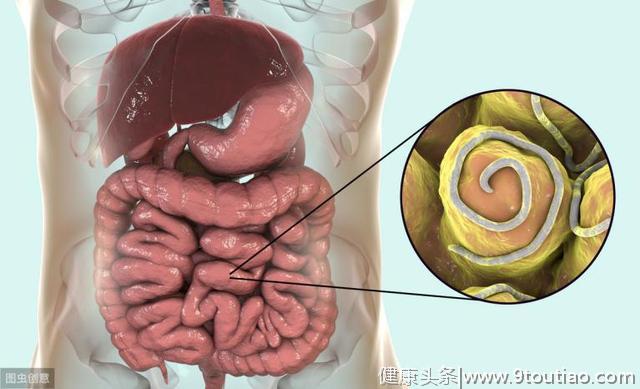 放屁多，就是肠癌吗？医生警示：排便时出现3种异常，千万别忽视