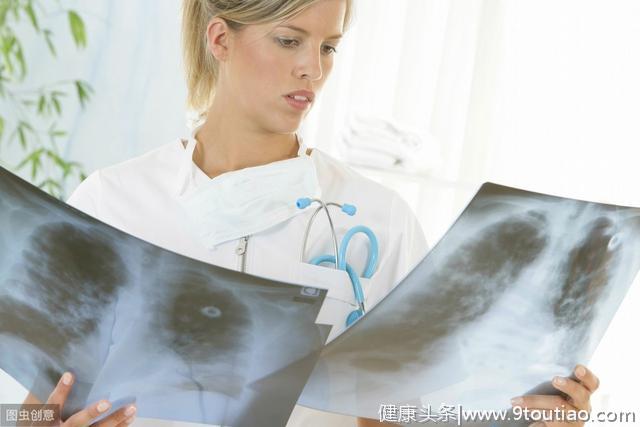 肺癌转移会有哪些症状？肺癌晚期骨转移还能活多久？