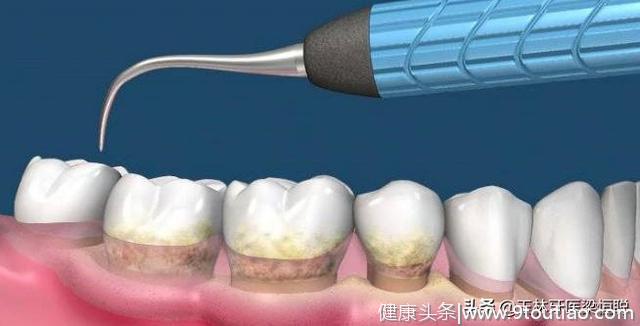 【科普】口腔科常见医嘱（值得收藏）