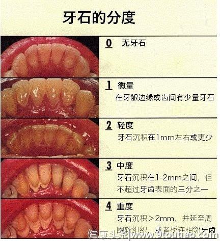 遇到这样的男生你第一反应是什么？打掉他们的牙齿？