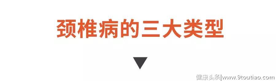 颈椎疼起来真要命，记住四招，跟着做，轻松“赶走”我们的颈椎病