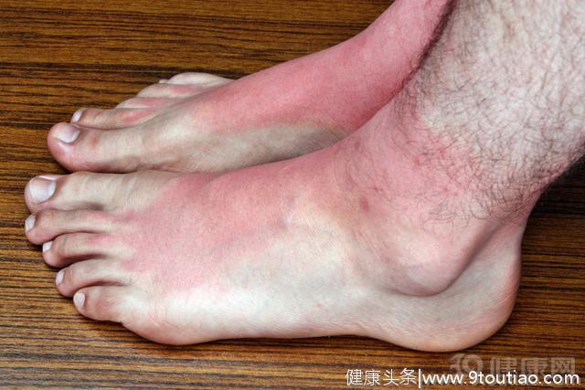 泡脚祛湿防感冒，但不注意四件事，反而会伤身