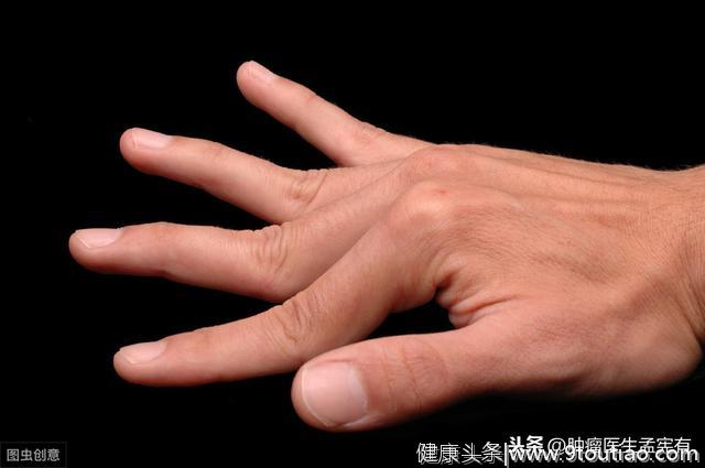 肺癌的早期征兆：锁骨深陷不是骨感美，粗大的手指头是坏兆头