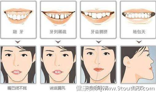 关于牙齿矫正有哪些误区-济宁丁香树口腔