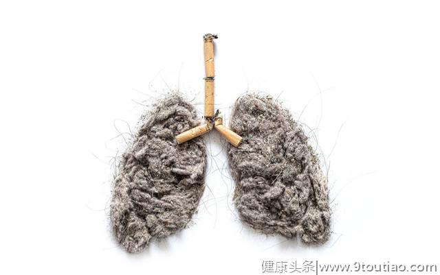 吸烟者，身体一旦出现“1大2痛”，八成是肺癌上身，快查肺CT