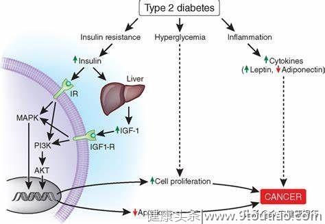 J Diabetes：中国的大型研究发现糖尿病与许多癌症有关