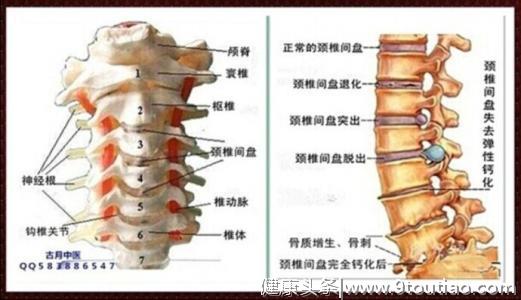 常见的颈椎病该怎么调护？送你一套简单实用的颈椎操