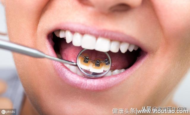 牙周病不能拖！牙齿出现5个状况，好好检查一下口腔