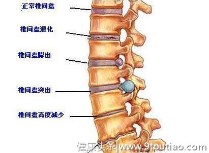 骨科医生：生活中不做“低头族”，轻松远离颈椎病！