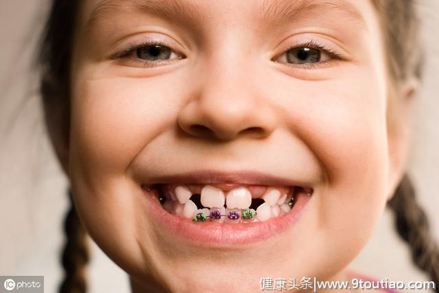 孩子有这些坏习惯，可千万不要等到换完牙齿再去矫正