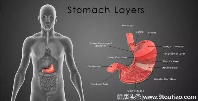 感染幽门螺杆菌到胃癌，有这4个发展阶段，到达第2个，胃癌并不远
