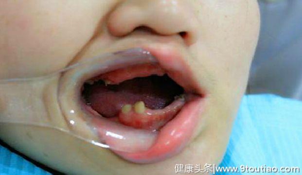 牙齿是人体的重要器官，对孩子牙齿的爱护不可小视，莫学这位宝贝