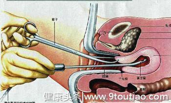 最糟蹋子宫的3种操作，大多男性都会“强求”，千万别“纵容”！