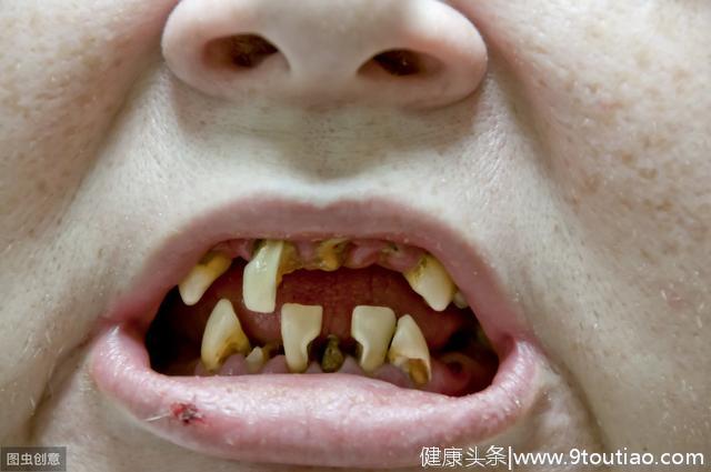 牙疼是因为上火？无知正在威胁你的口腔健康！
