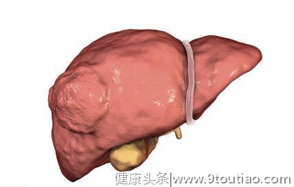 47岁女子肝癌入院，积极治疗无果，医生惋惜：都是"吃"出来的病