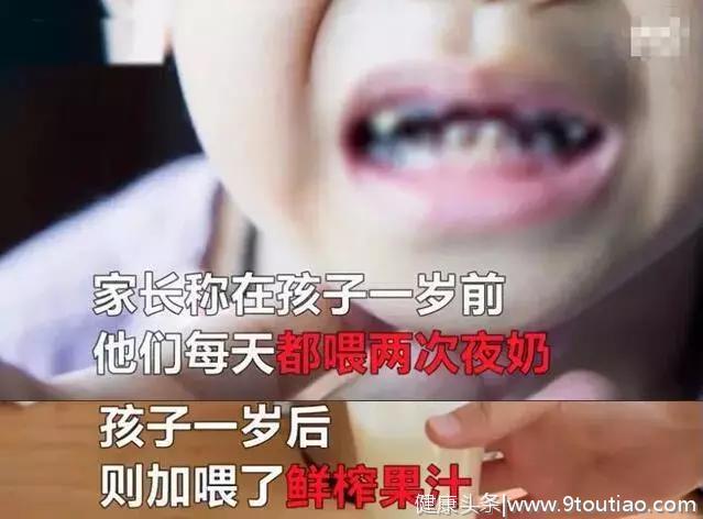 可怕！2岁半宝宝牙齿“全烂光”，别让这些坏习惯害了孩子！