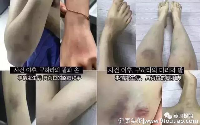 具荷拉抑郁自杀，“家暴男友”却开心赚钱？