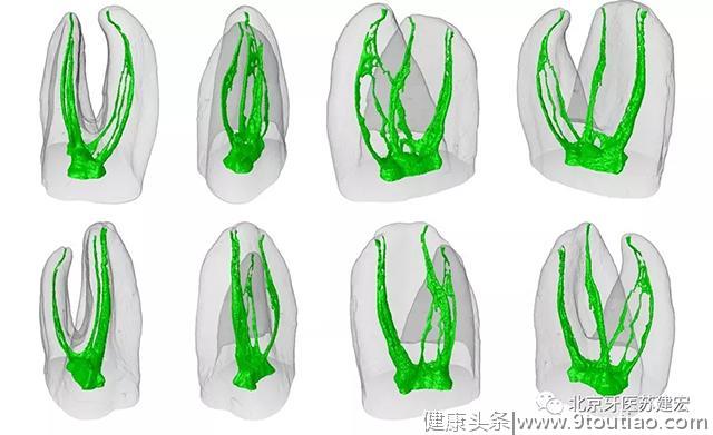 根管治疗是现代牙科诊疗体系的基石