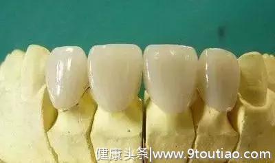 为什么医生镶一颗牙要磨两边的牙齿？