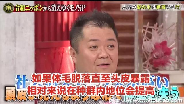 日本全亚洲脱发率第一！他们说：秃可能是人类进化的方向。