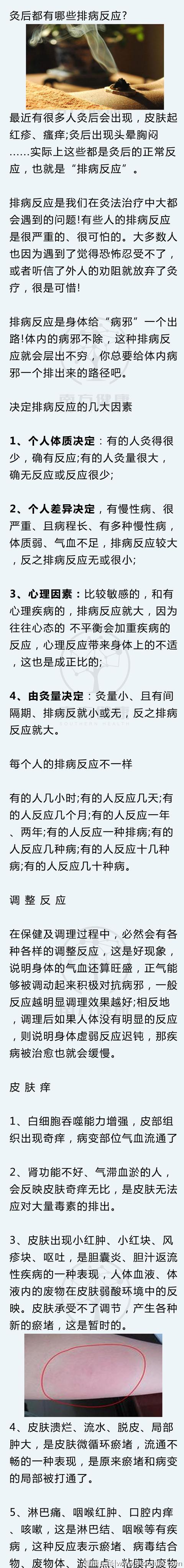 灸后出现这些症状，正是艾灸起了作用，千万别停灸！