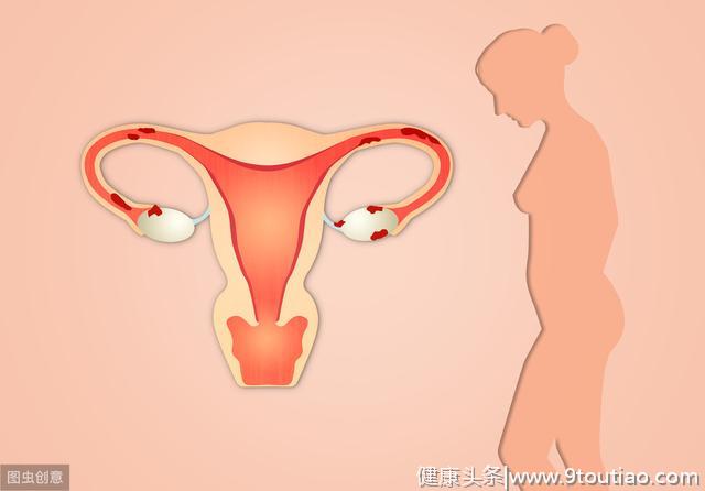 子宫肌瘤是怎么长出来的？
