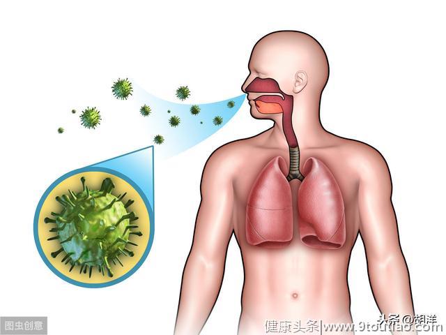 运动后患肺炎，气管镜冲洗治疗后好转，儿童肺炎可考虑气管镜治疗