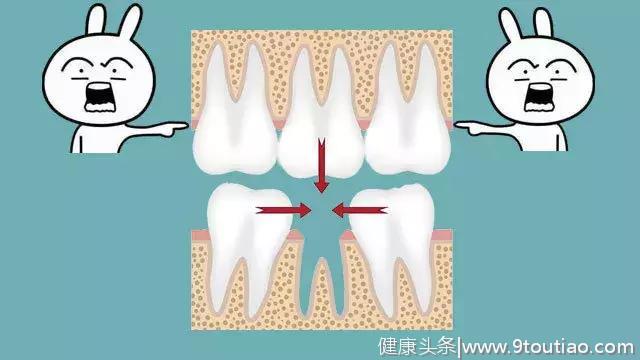 注意了！你牙齿上这个小黑洞，是个烧钱的无底洞