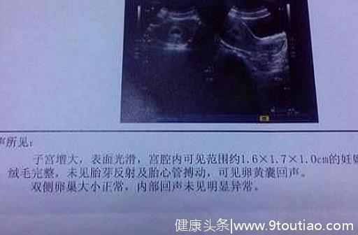女人怀孕多久，b超检查可以看到孕囊？附：孕囊发育周期表