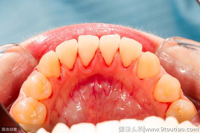 经常牙龈出血，要警惕这些健康问题正准备伤害你！