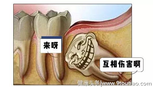 拔了智齿真的可以瘦脸吗？