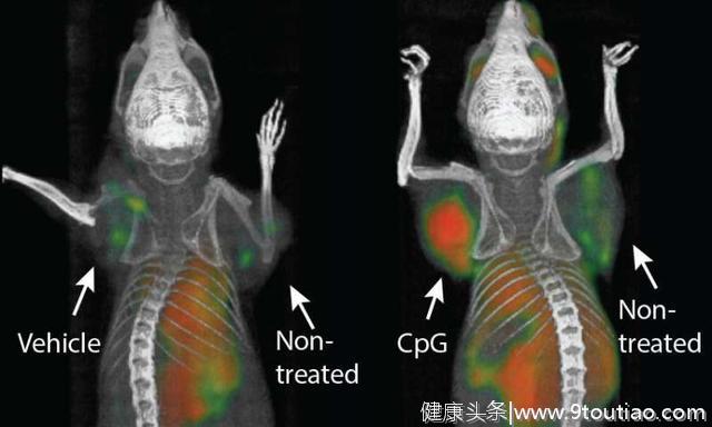 研究人员发现，癌症“疫苗”可以消除小鼠的肿瘤