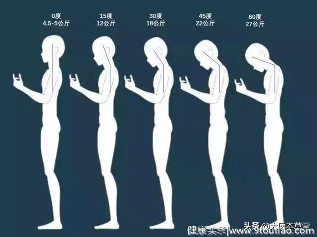 颈椎病分10级，超过2级就要注意了！