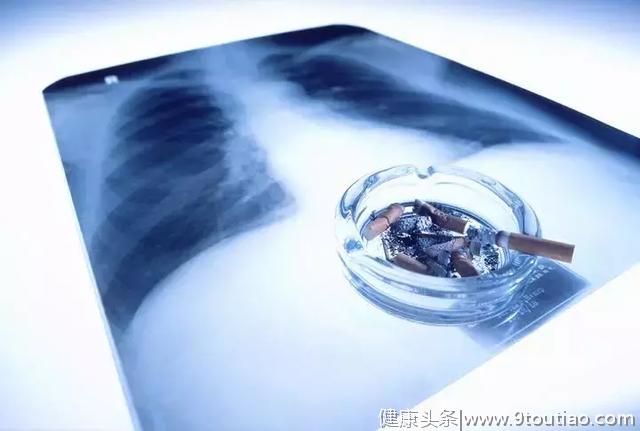 经常咳嗽没在意，浙江21岁女孩查出肺癌晚期，5天后离世！手术化疗都没来得及