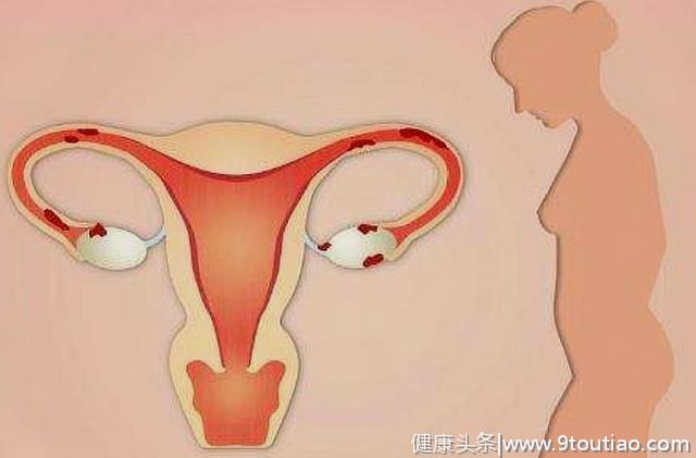 子宫内膜薄，可能和这3个行为有关，备孕的你可以自查