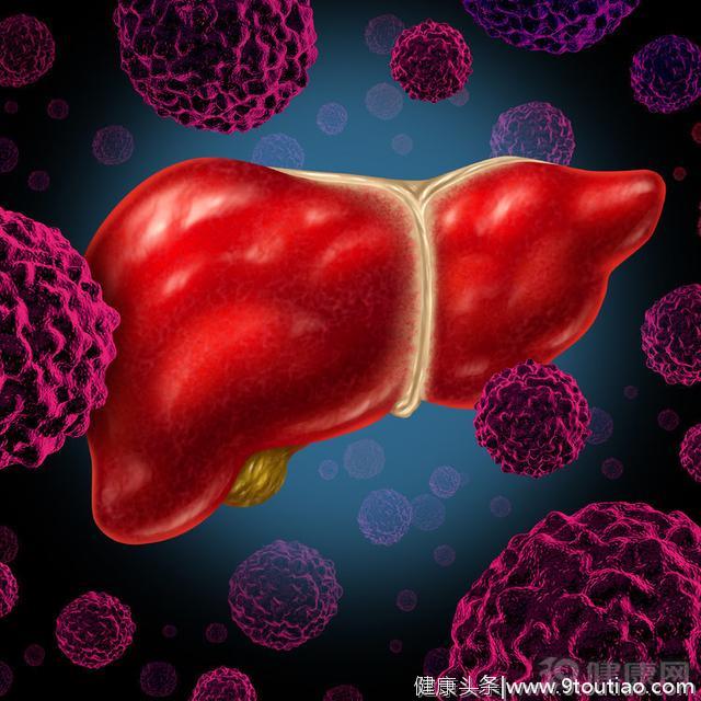 从乙肝到肝癌需要几步？5个方面不注意，当心避不开