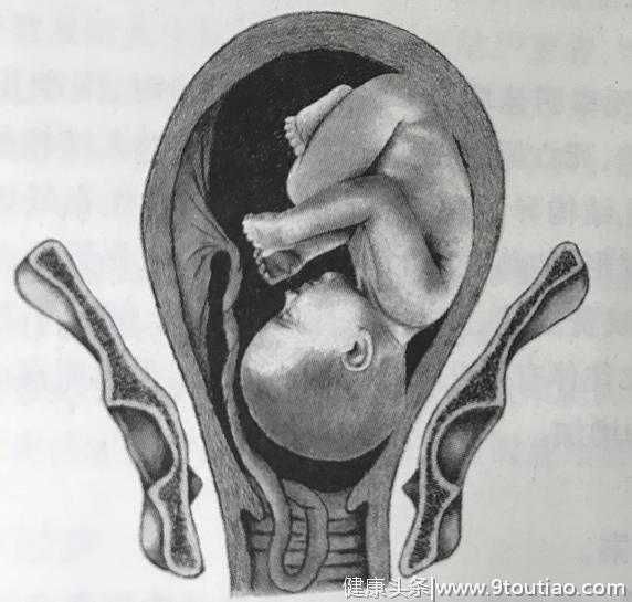 怀孕7个月，脐带突然“掉出来”！孕妈泪流满面：救救我的孩子