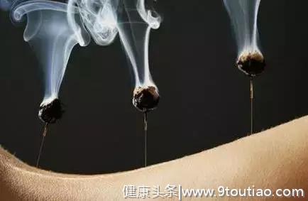 缓解腰腿疼痛，试试针灸，揭秘收藏的三个针灸妙方