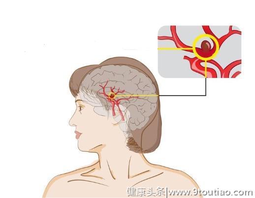 3大恶性肿瘤是癌症界的“伪装者”，身体一旦出现异常，及时筛查