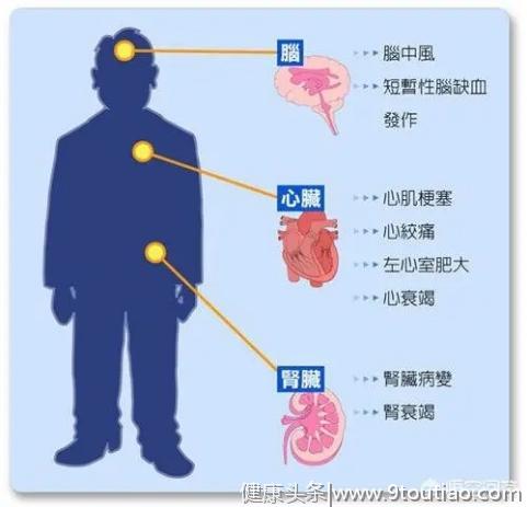 长期高血压控制不好，一定注意这5个脏器是不是受损了