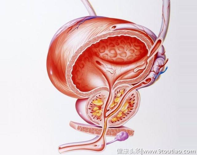 46岁男子无法排尿，查出前列腺癌，病床前痛哭：都是"妻子"害的