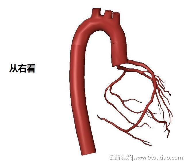 冠心病的科普文章，这一篇是最精美，最简洁易懂的