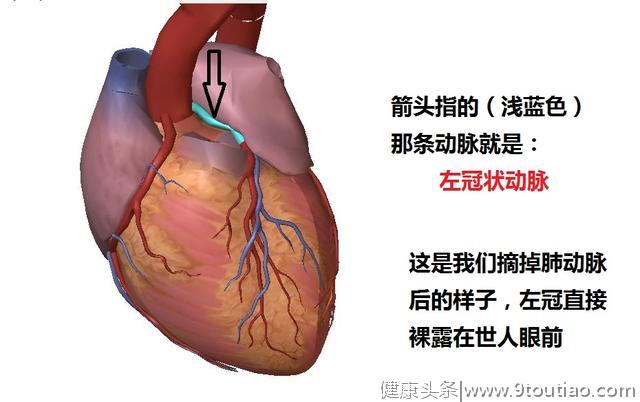 冠心病的科普文章，这一篇是最精美，最简洁易懂的