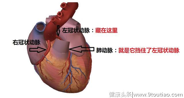 冠心病的科普文章，这一篇是最精美，最简洁易懂的