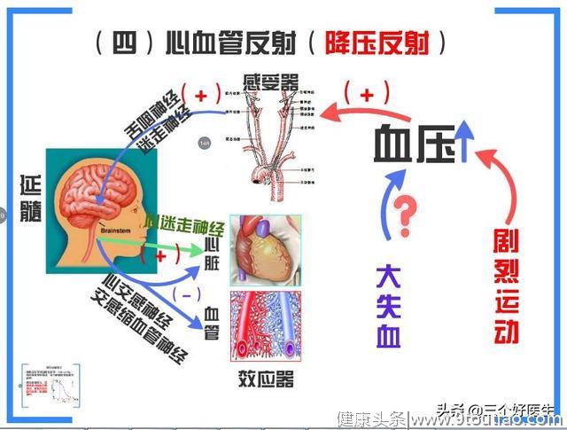 中风的元凶原来是“颈椎”