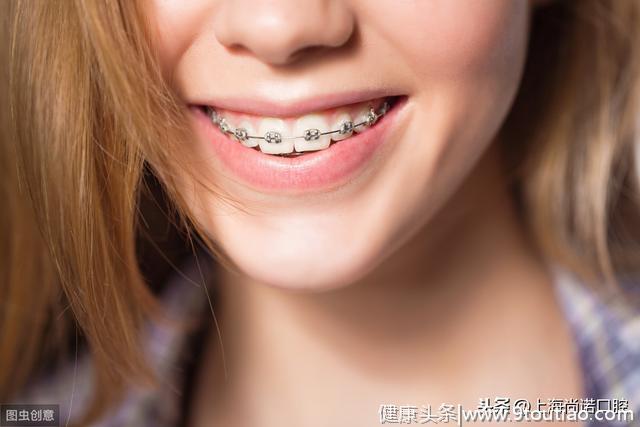 三种方式：牙齿这样变美 你知道多少？
